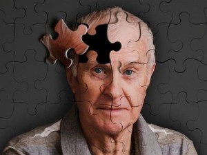 Αλτσχάιμερ:  Πολλά υποσχόμενη η δοκιμή του πρώτου βηματοδότη εγκεφάλου
