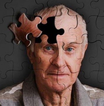 Αλτσχάιμερ:  Πολλά υποσχόμενη η δοκιμή του πρώτου βηματοδότη εγκεφάλου