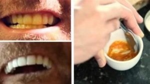 Αυτός ο Άνδρας μας Δείχνει ΠΩΣ να Λευκάνουμε Μόνοι τα Δόντια μας