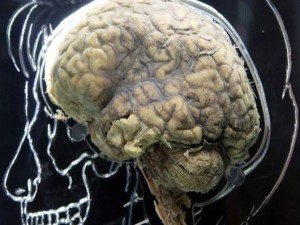 Βρετανοί ερευνητές εντόπισαν το «κέντρο της γενναιοδωρίας» στον εγκέφαλο