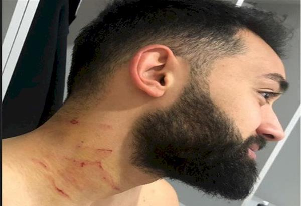 Τούρκος ποδοσφαιριστής έκοψε αντίπαλο με λεπίδα που είχε μαζί του στο γήπεδο. Βίντεο