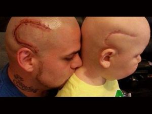 Πατέρας κάνει τατουάζ την ουλή του καρκινοπαθούς γιου του για να τον υποστηρίξει