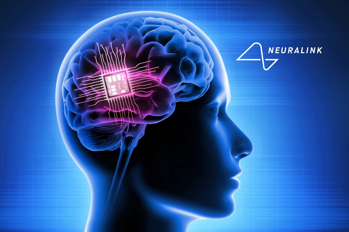 Neuralink – Δυσλειτουργία στο εμφύτευμα εγκεφάλου που τοποθετήθηκε σε ασθενή